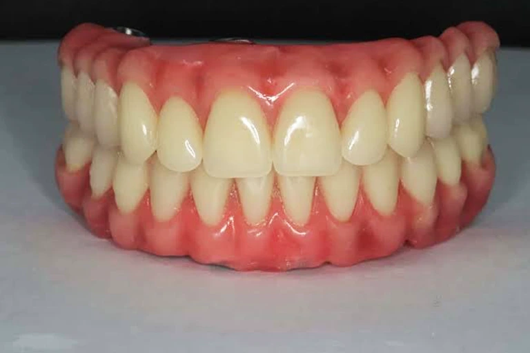 Próteses Dentárias